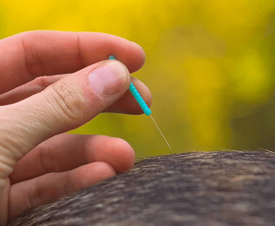 Acupuncture